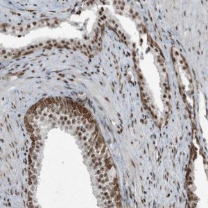 Anti-TADA2B antibody produced in rabbit 