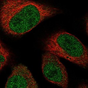 Anti-TADA3 antibody produced in rabbit 