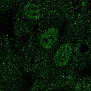 Anti-TAL1 antibody produced in rabbit 