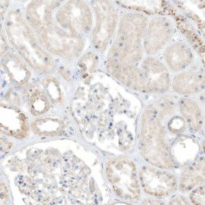 Anti-TAL2 antibody produced in rabbit 