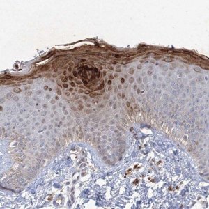 Anti-TANC1 antibody produced in rabbit 
