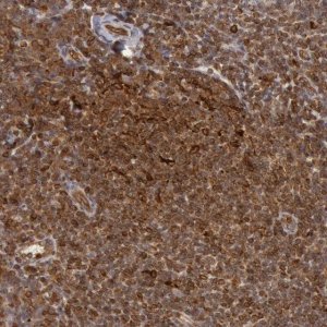 Anti-TAP2 antibody produced in rabbit 