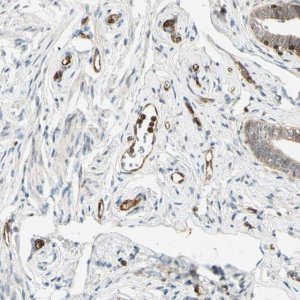 Anti-TAPBP antibody produced in rabbit 