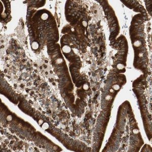 Anti-TAPBP antibody produced in rabbit 