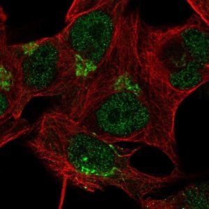 Anti-TBC1D14 antibody produced in rabbit 
