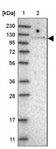 Anti-TBC1D2 antibody produced in rabbit HPA030871-100UL