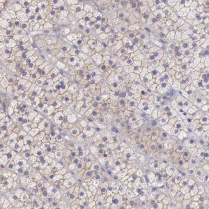 Anti-TBC1D22A antibody produced in rabbit 