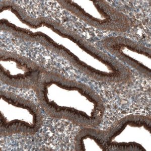 Anti-TBC1D23 antibody produced in rabbit 