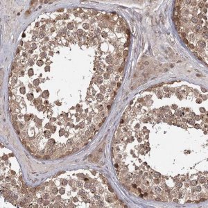 Anti-TBC1D23 antibody produced in rabbit HPA038152-100UL