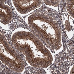 Anti-TBC1D23 antibody produced in rabbit HPA038152-100UL