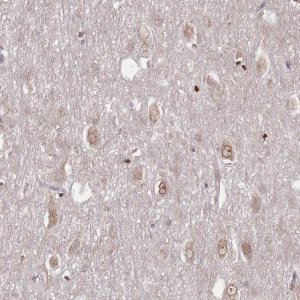 Anti-TBC1D25 antibody produced in rabbit 
