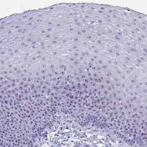 Anti-TBC1D29 antibody produced in rabbit 