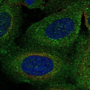 Anti-TBC1D2B antibody produced in rabbit 