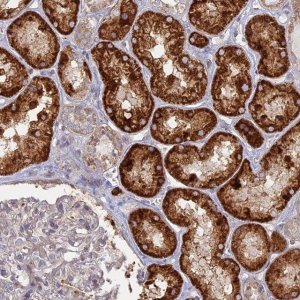 Anti-TBC1D30 antibody produced in rabbit HPA039772-100UL