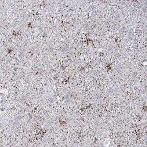 Anti-TBC1D7 antibody produced in rabbit 