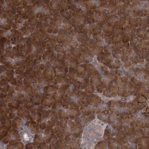 Anti-TBC1D9B antibody produced in rabbit 