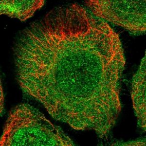 Anti-TBC1D9B antibody produced in rabbit 