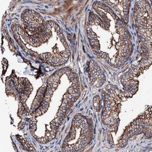 Anti-TBCEL antibody produced in rabbit 