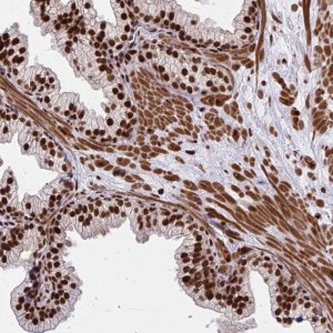 Anti-TBL1Y antibody produced in rabbit 