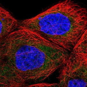 Anti-TBL2 antibody produced in rabbit 