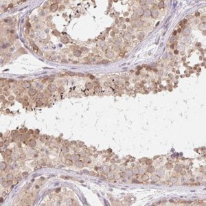 Anti-TBPL2 antibody produced in rabbit 