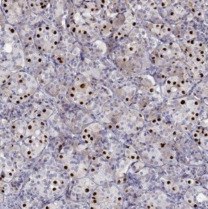Anti-TBX19 antibody produced in rabbit 