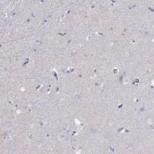 Anti-TBX19 antibody produced in rabbit 
