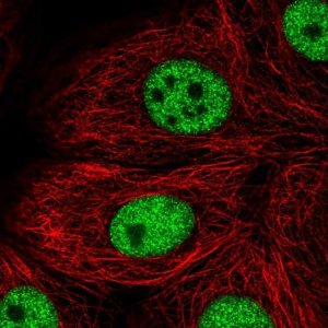 Anti-TBX2 antibody produced in rabbit 