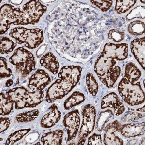 Anti-TCAF2 antibody produced in rabbit 