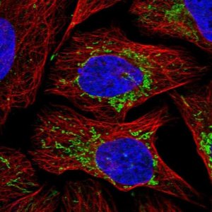 Anti-TCIRG1 antibody produced in rabbit 