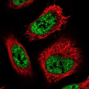 Anti-TCP11L2 antibody produced in rabbit 