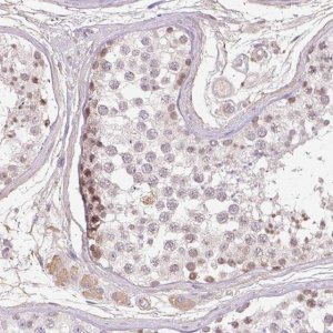 Anti-TDRD15 antibody produced in rabbit 
