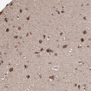 Anti-TENM1 antibody produced in rabbit 