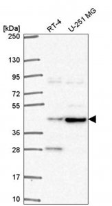 Anti-TEPSIN antibody produced in rabbit 