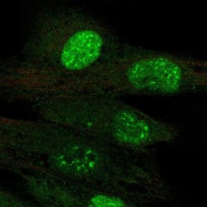 Anti-TERT antibody produced in rabbit 