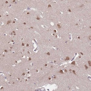 Anti-TFAP2D antibody produced in rabbit 