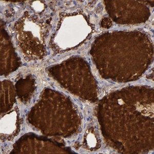 Anti-TG antibody produced in rabbit 