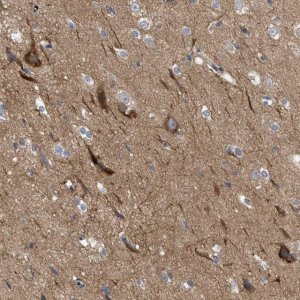 Anti-THRA antibody produced in rabbit 