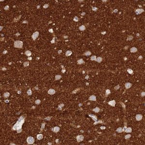 Anti-TIFAB antibody produced in rabbit 