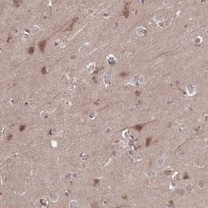 Anti-TIGAR antibody produced in rabbit 
