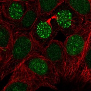 Anti-TIGD1 antibody produced in rabbit 