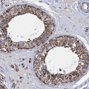 Anti-TIMM10 antibody produced in rabbit 