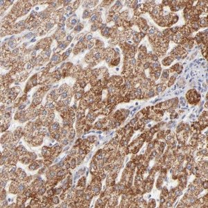 Anti-TIMM8A antibody produced in rabbit 