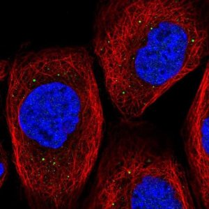 Anti-TIPRL antibody produced in rabbit 