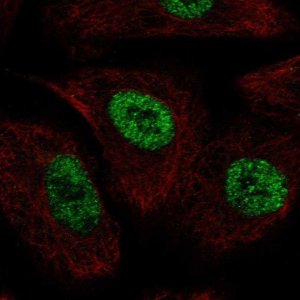 Anti-TLE1 antibody produced in rabbit 