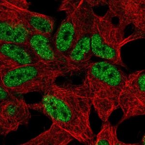 Anti-TLX2 antibody produced in rabbit 