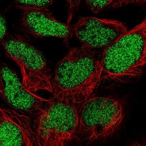 Anti-TM2D1 antibody produced in rabbit 