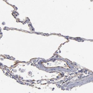 Anti-TM4SF1 antibody produced in rabbit 