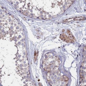 Anti-TMBIM6 antibody produced in rabbit 