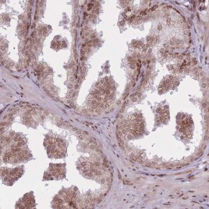 Anti-TMC6 antibody produced in rabbit 